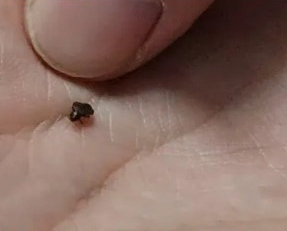 빈대 퇴치법 물렸을때 증상과 예방 방법