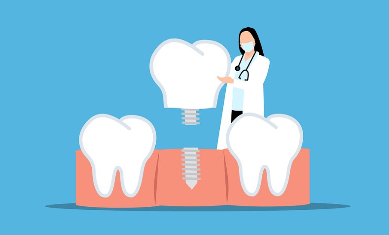 울산-남구-임플란트-치과-가격-비용-싼-곳,저렴한-곳,잘하는-곳,유명한-곳-BEST20-추천1