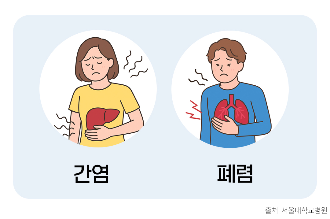#대상포진 합병증 증상 #간염, 폐렴