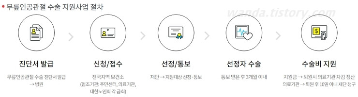 무릎 인공관절 수술 지원사업 절차