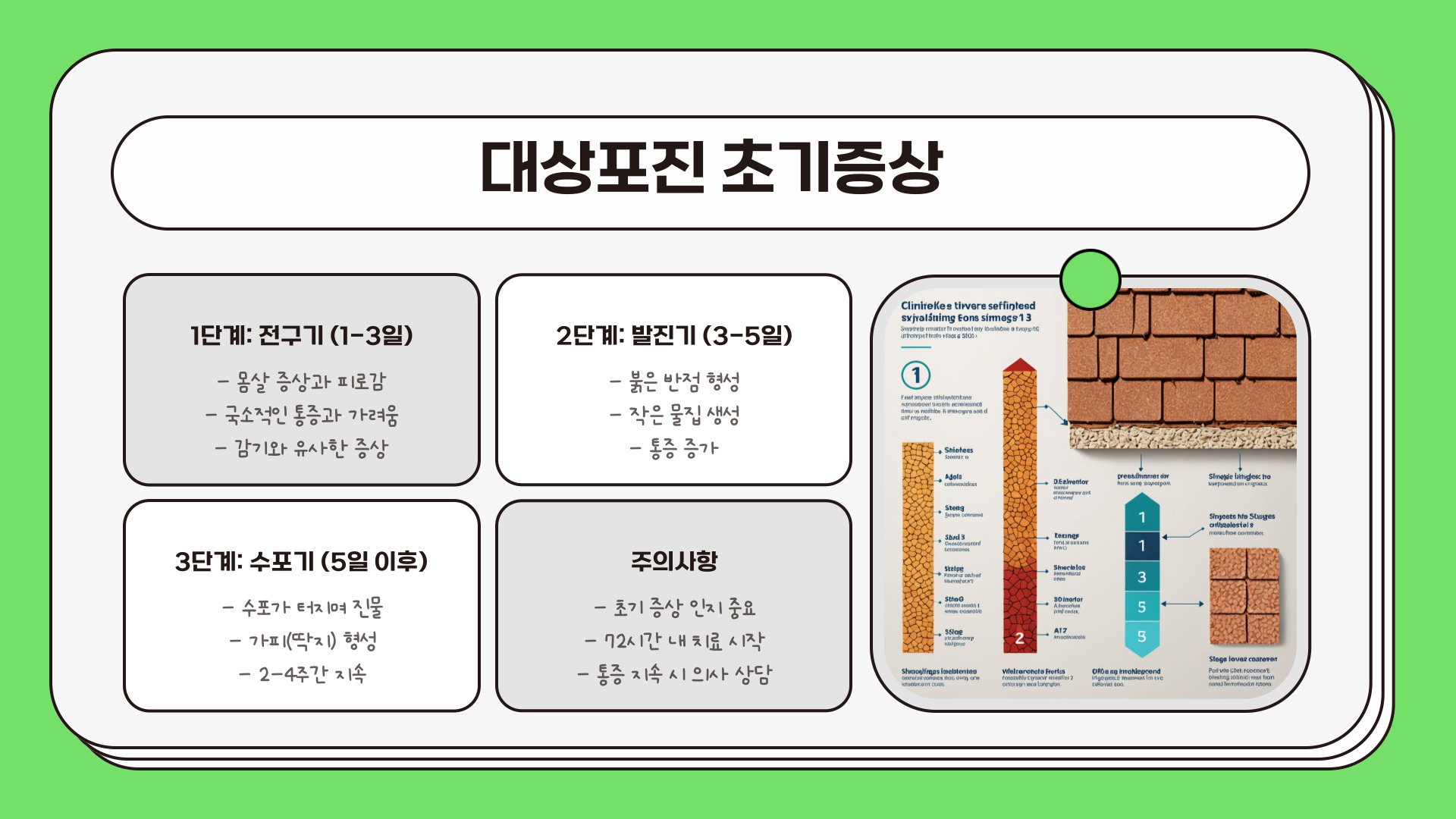 대상포진 초기증상