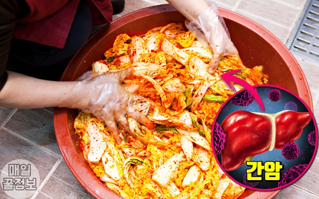 썩은 생강 구별법, 상한 생강 구별법, 김치 간암 원인, 건강 팁줌 매일꿀정보