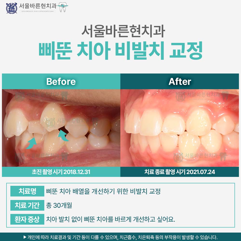 부산교정치과