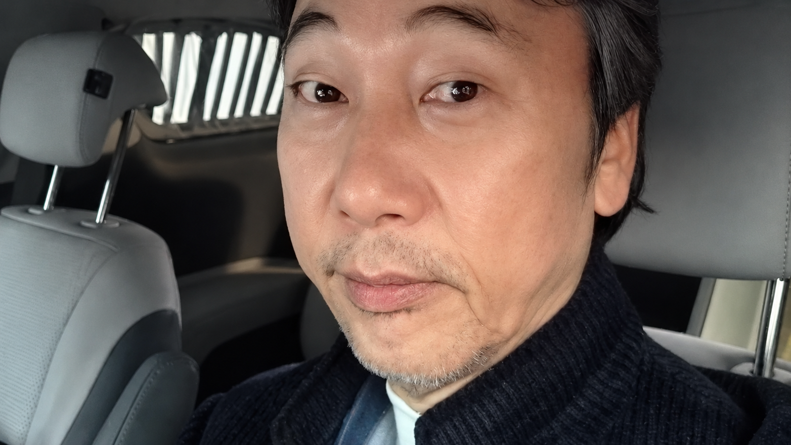 이문세 백내장 수술