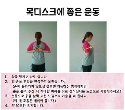 목디스크 치료방법과 좋은 운동 및 증상