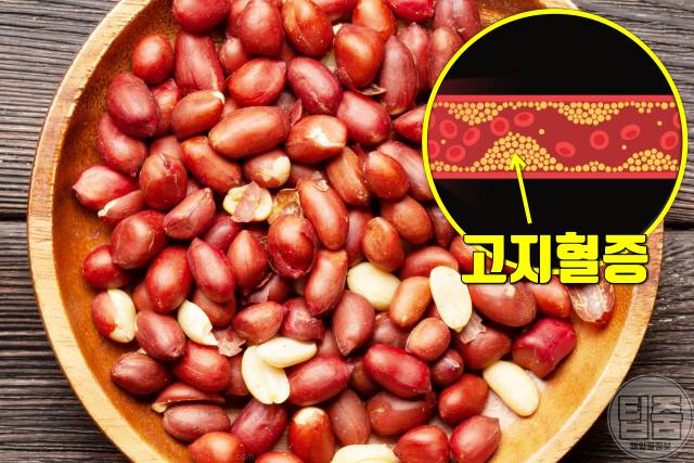 고지혈증 좋은 음식 땅콩 고지혈증약 스타틴 효과