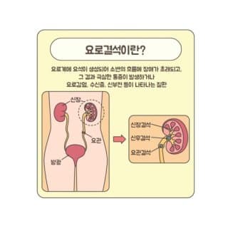 요로결석 증상