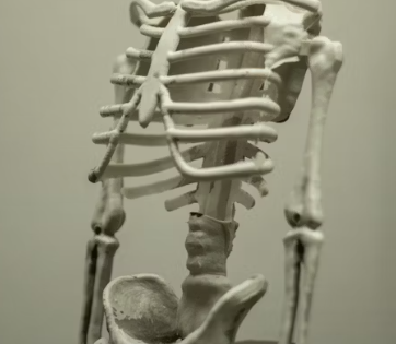 골다공증 치료방법 진단기준 예방법