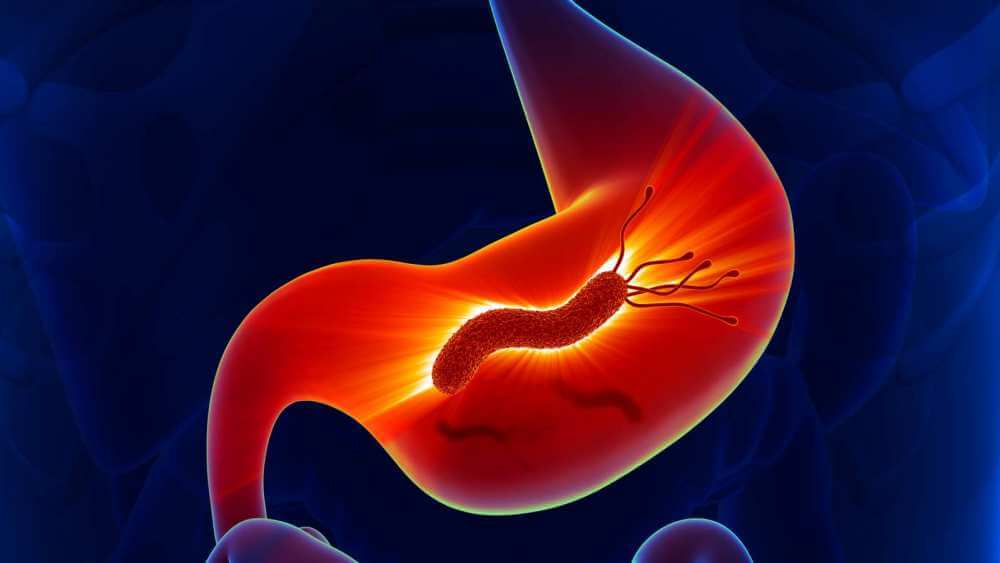 헬리코박터균을 억제하는 자연 식품 공개