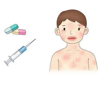 프로폴리스-효능-알레르기
