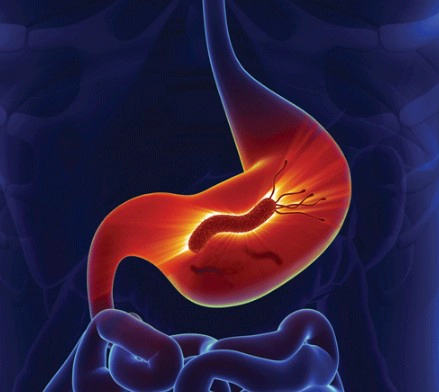 헬리코박터균 증상 8가지