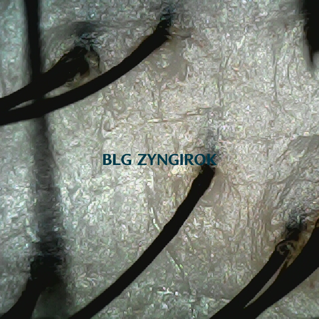 탈모 극복 프로젝트 - 뒷머리 두피 모습이다.