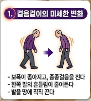 파킨슨병 초기증상
