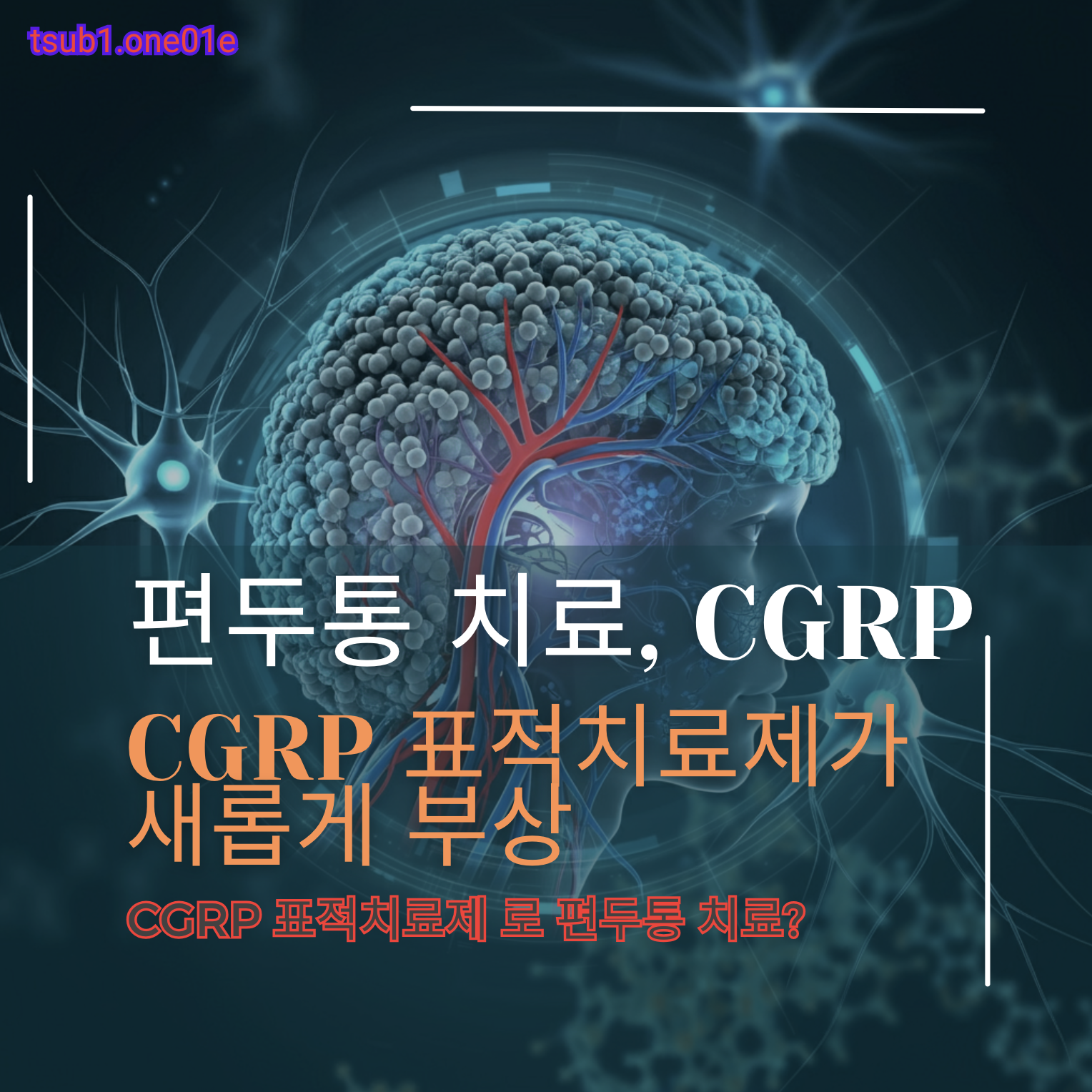 편두통 치료, CGRP 표적치료제가 새롭게 부상