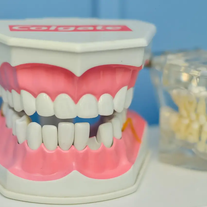 스케일링 보험 적용 외 추가로 비용 드는 경우2