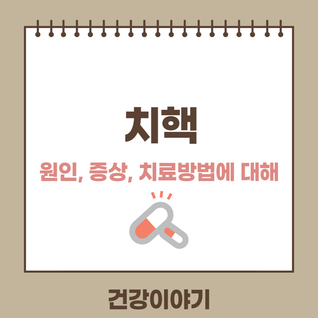 치핵 원인 증상 치료