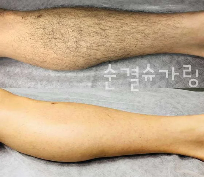 순결