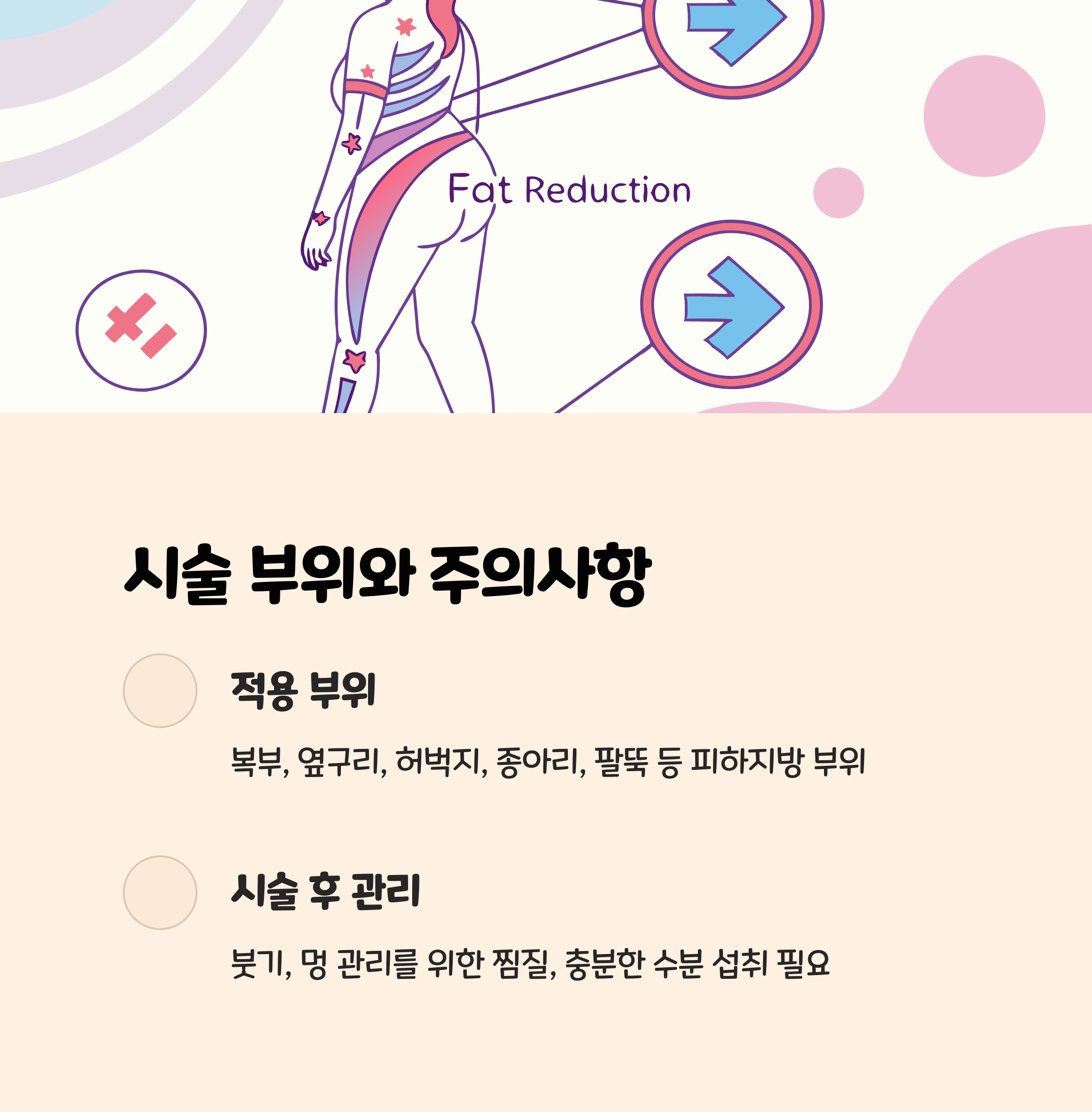 시술 부위와 주의사항, 이것만은 알고 가자