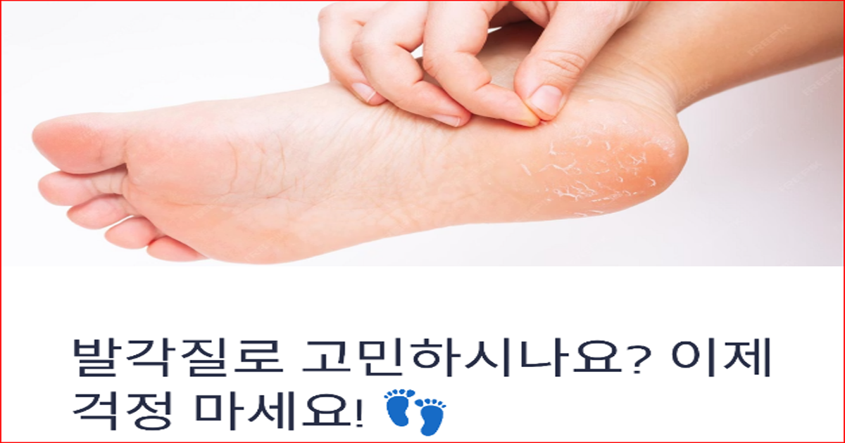 뒤꿈치에 풋필링 스프레이를 고르게 분사하는 모습