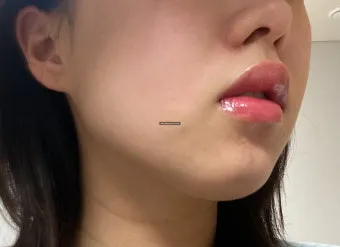 입술 두꺼운 남자 관상 특징과 해석_19