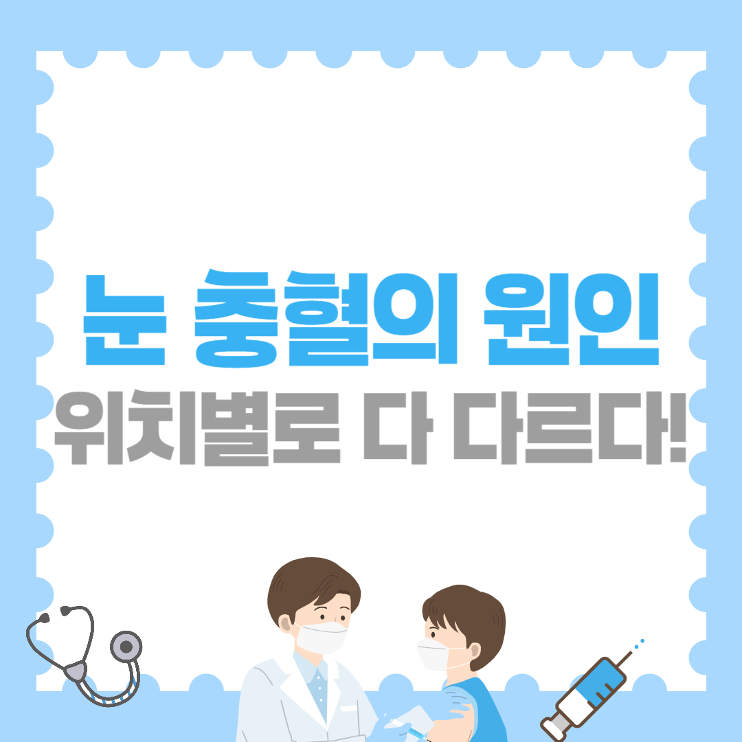 눈 충혈의 원인, 위치별로 다 다르다!