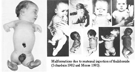 탈리도마이드(Thalidomide)