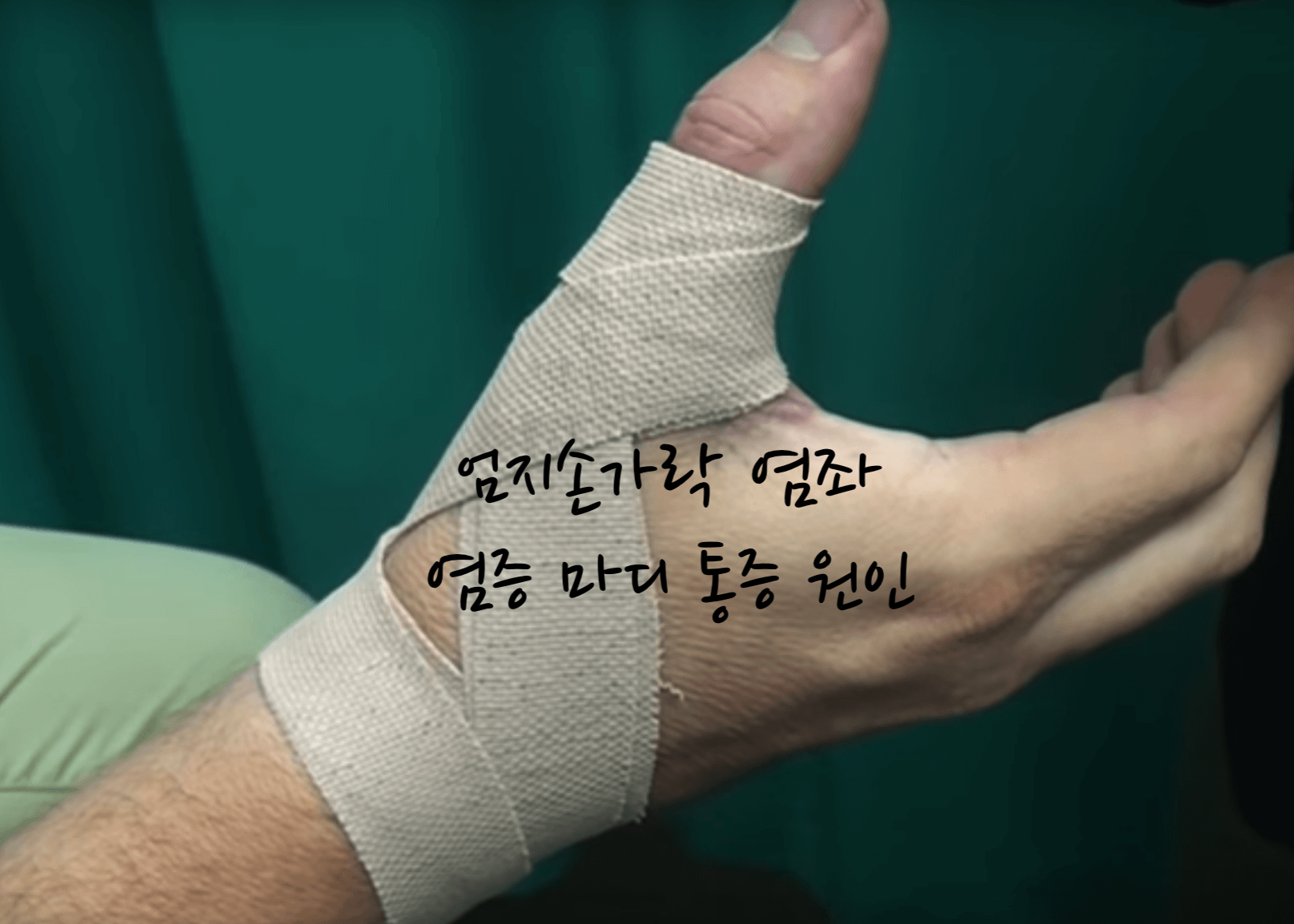 엄지손가락 통증