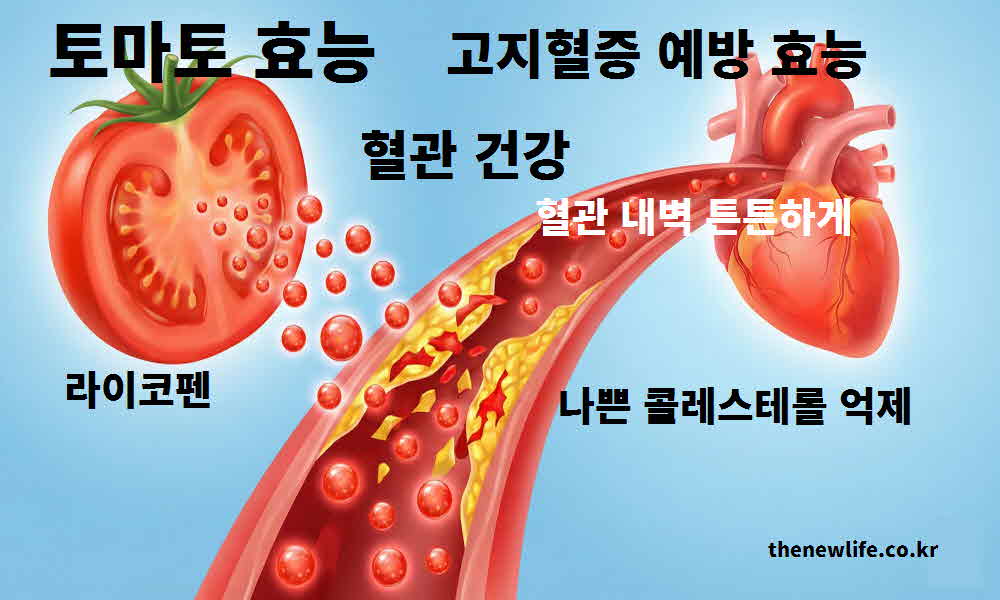 토마토 효능 혈관 건강 고지혈증 예방