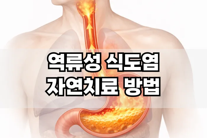 역류성 식도염 자연치료 방법