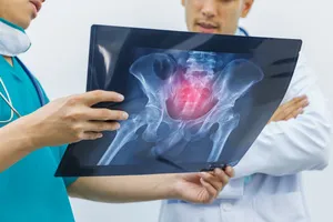 고관절-통증-원인