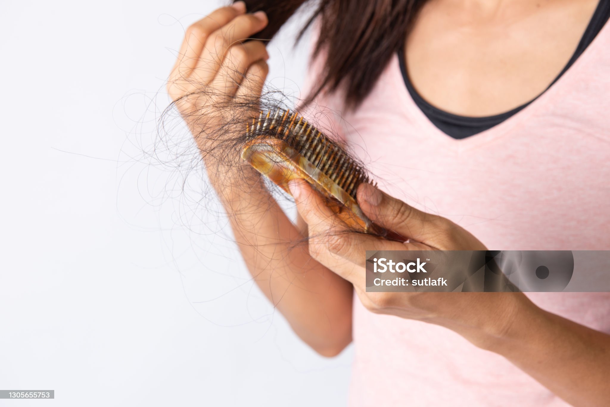 다이어트 부작용_머리가 빠지는 탈모관련 사진