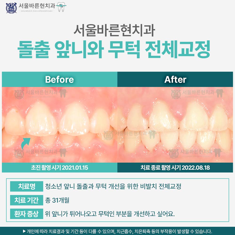 해운대교정치과