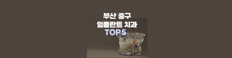 임플란트-치과-TOP5-썸네일