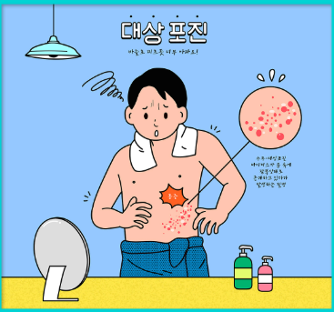 대상포진예방접종&amp;#44; 백신종류 비용