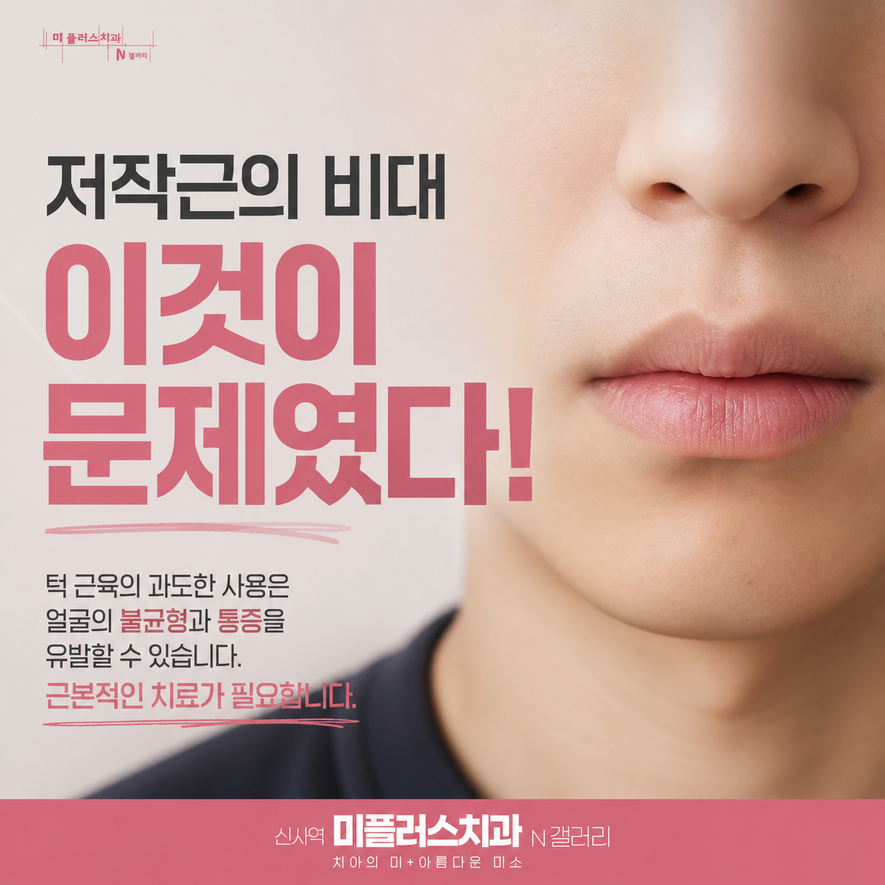 저작근 비대가 나타난 턱 근육 모습, 턱 통증 원인 설명 이미지