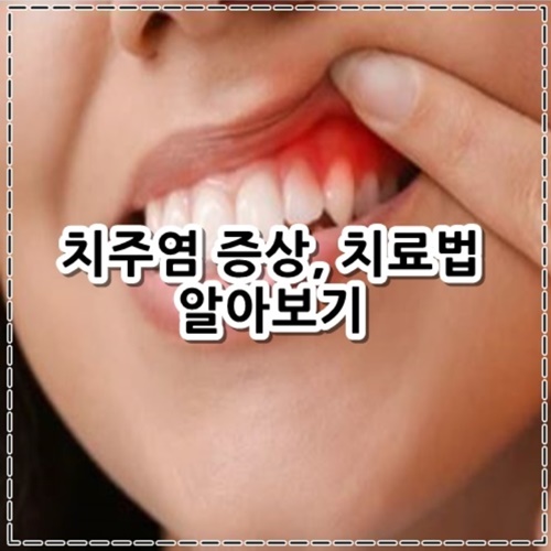 치주염 증상&#44; 치료법 알아보기