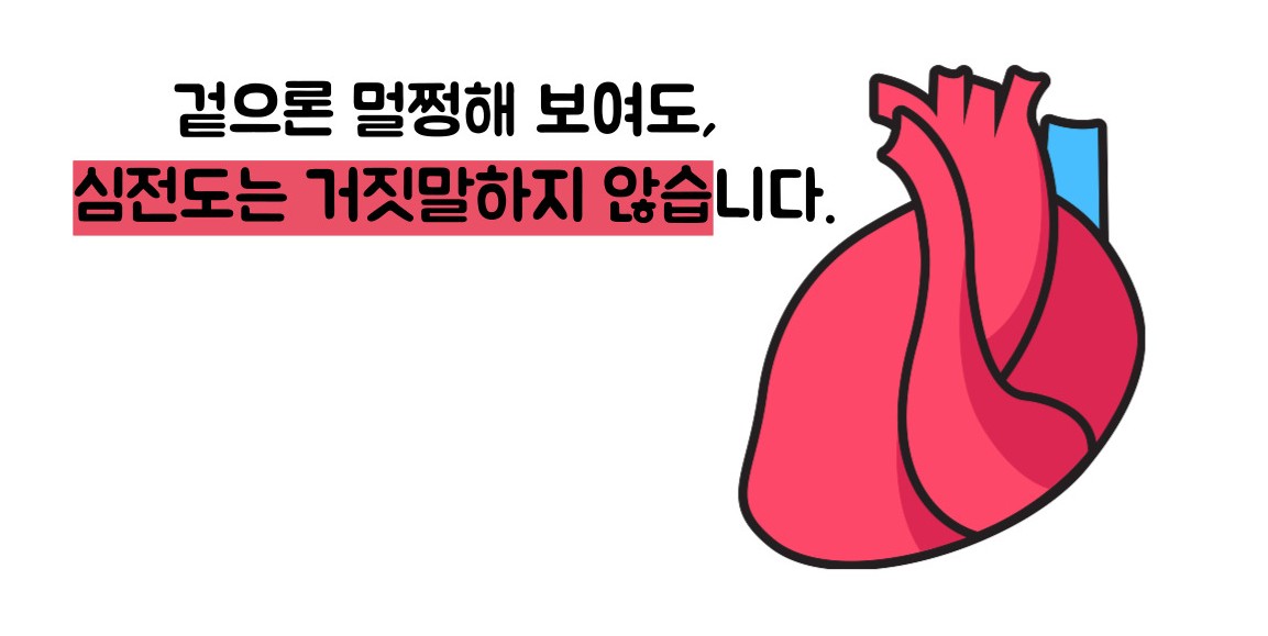 심전도 검사