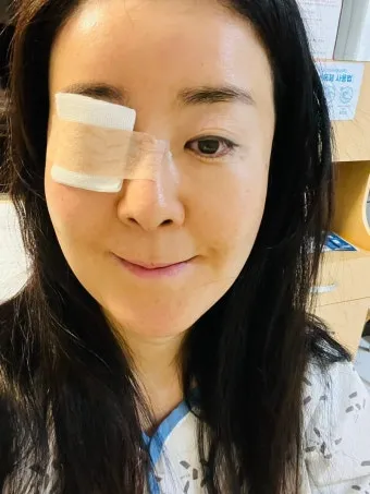 눈물샘 뚫는 수술 간단한가요에 대한 수술정보_15