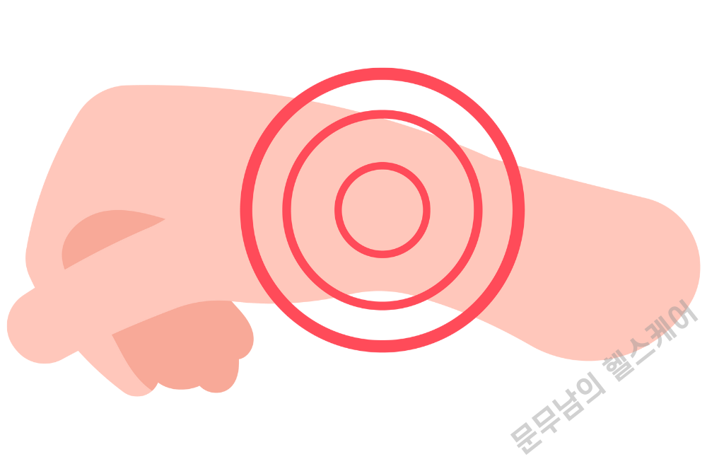 엄지 손가락 통증 원인 알아보자