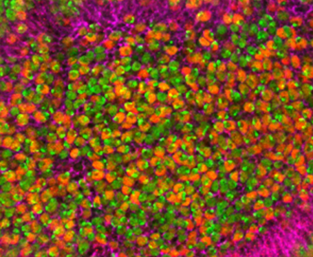 엽산 효능 : 면역력 강화