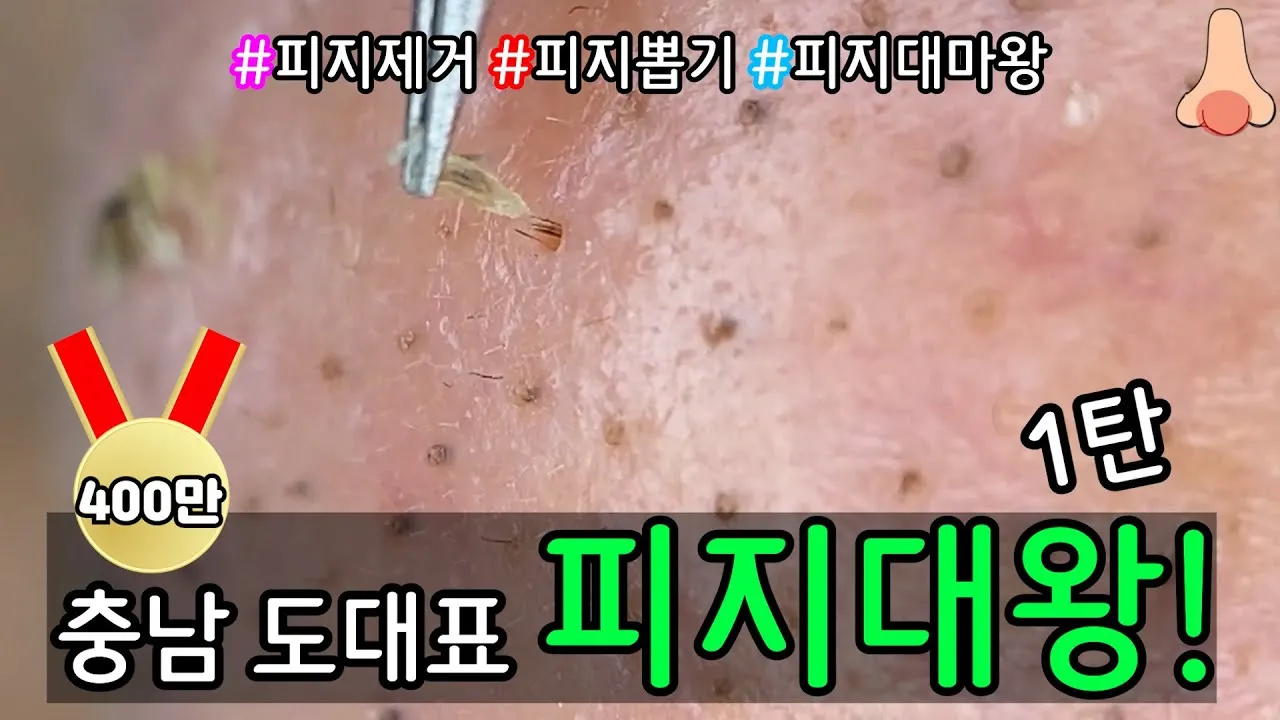 남자 얼굴 피지 제거 화장품 꿀템_1
