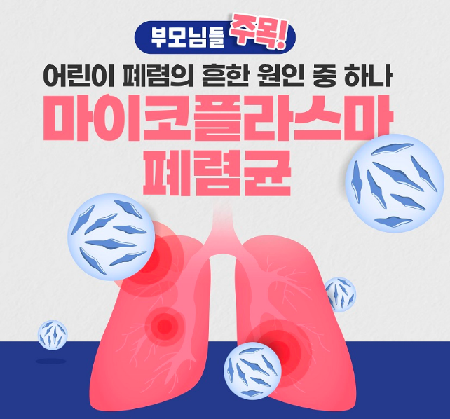 중국폐렴 마이코플라스마 증상 및 예방법 알아보기