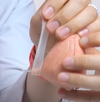 요실금 수술 설명 의사 시뮬레이션