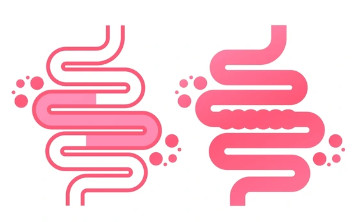 마그밀정 부작용