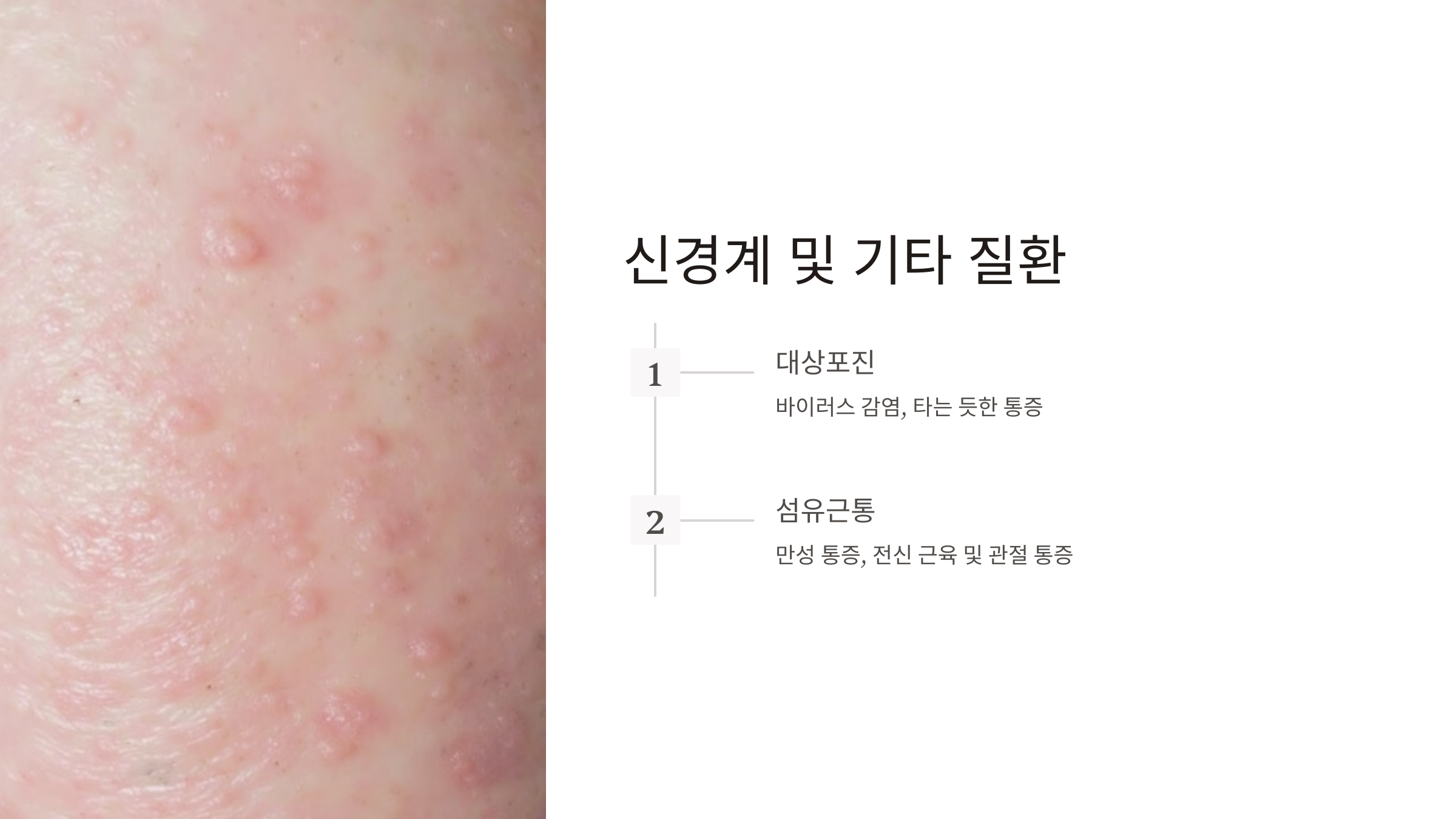 등 통증이 의심되는병