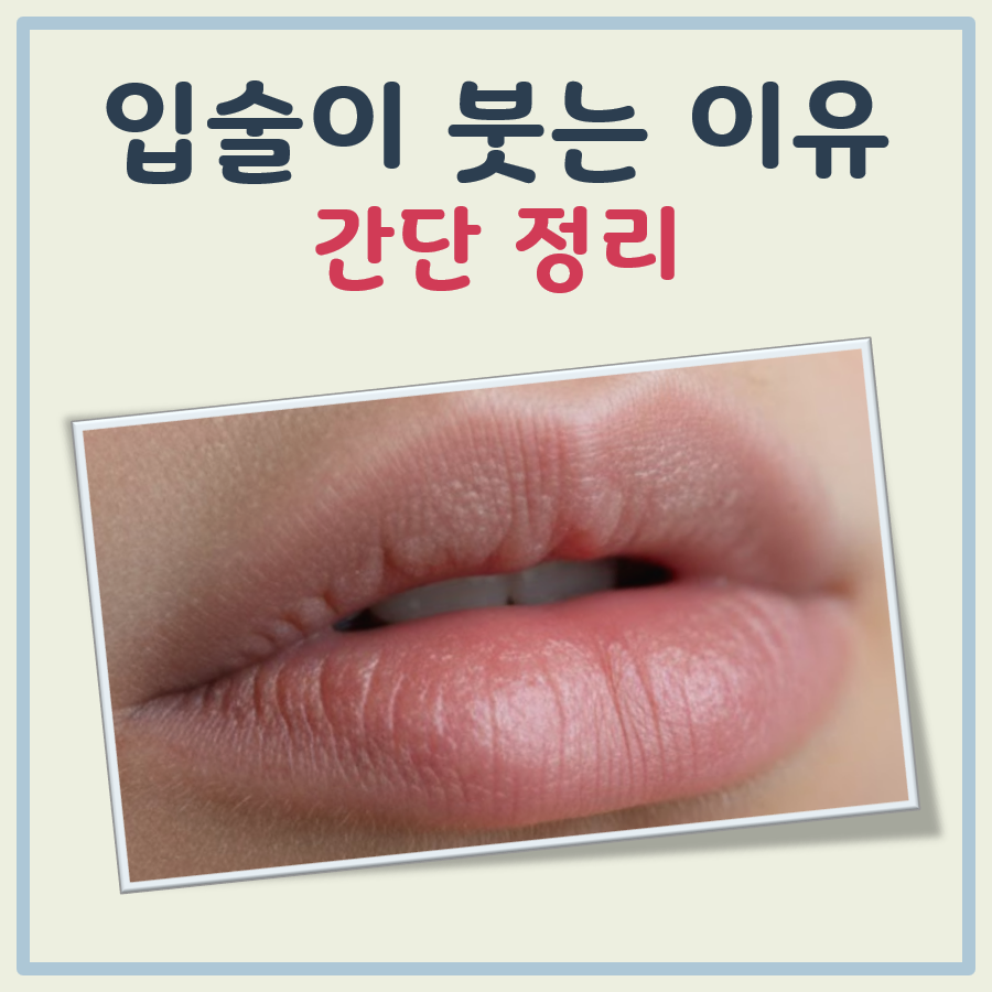입술이 붓는 이유 대표 이미지