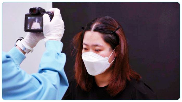 명의-여성-탈모