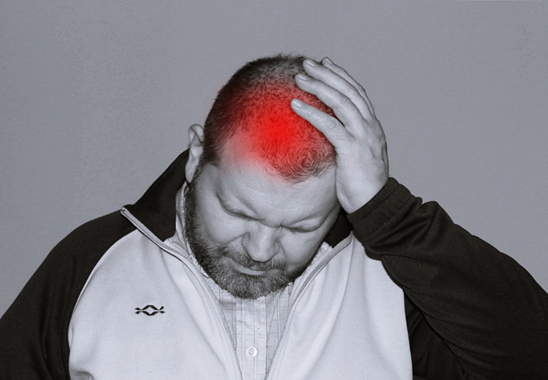 신경 베체트병(Neuro-Behçet's Disease), 뇌/신경계를 공격하는 변종