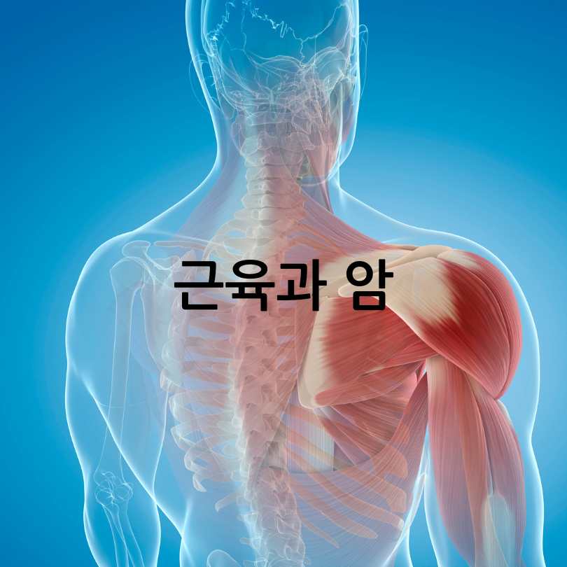 근육과암