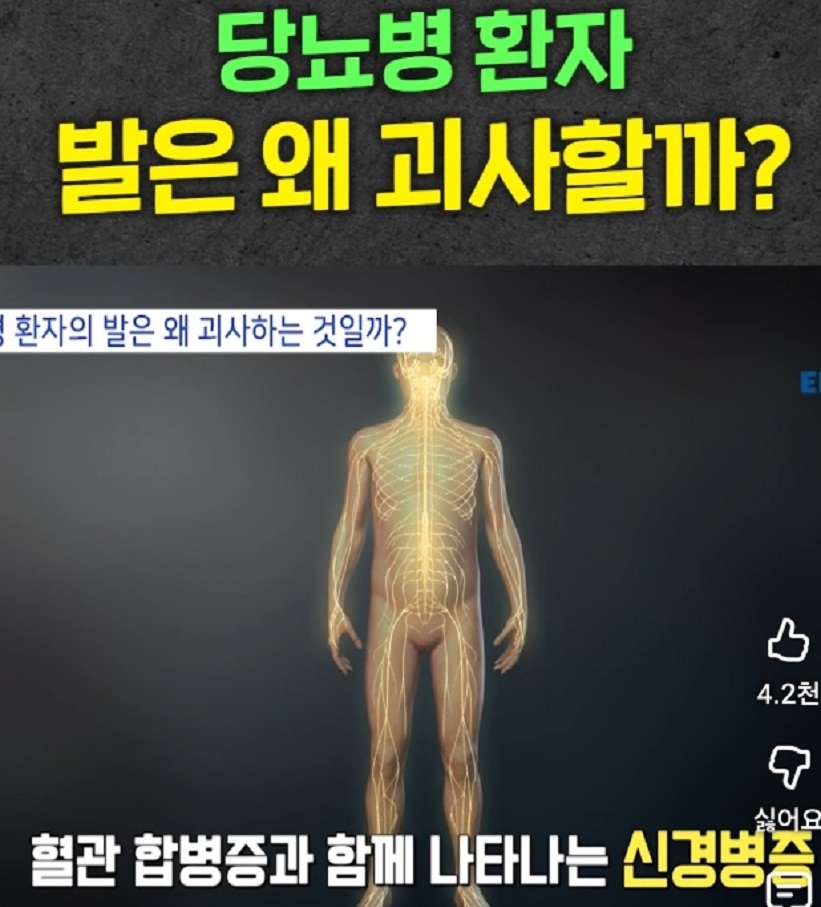 천동일-교수-당뇨병증상